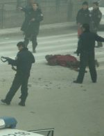 Self-immolated man asked to amputate his legs Self-immolated man asked to amputate his legs